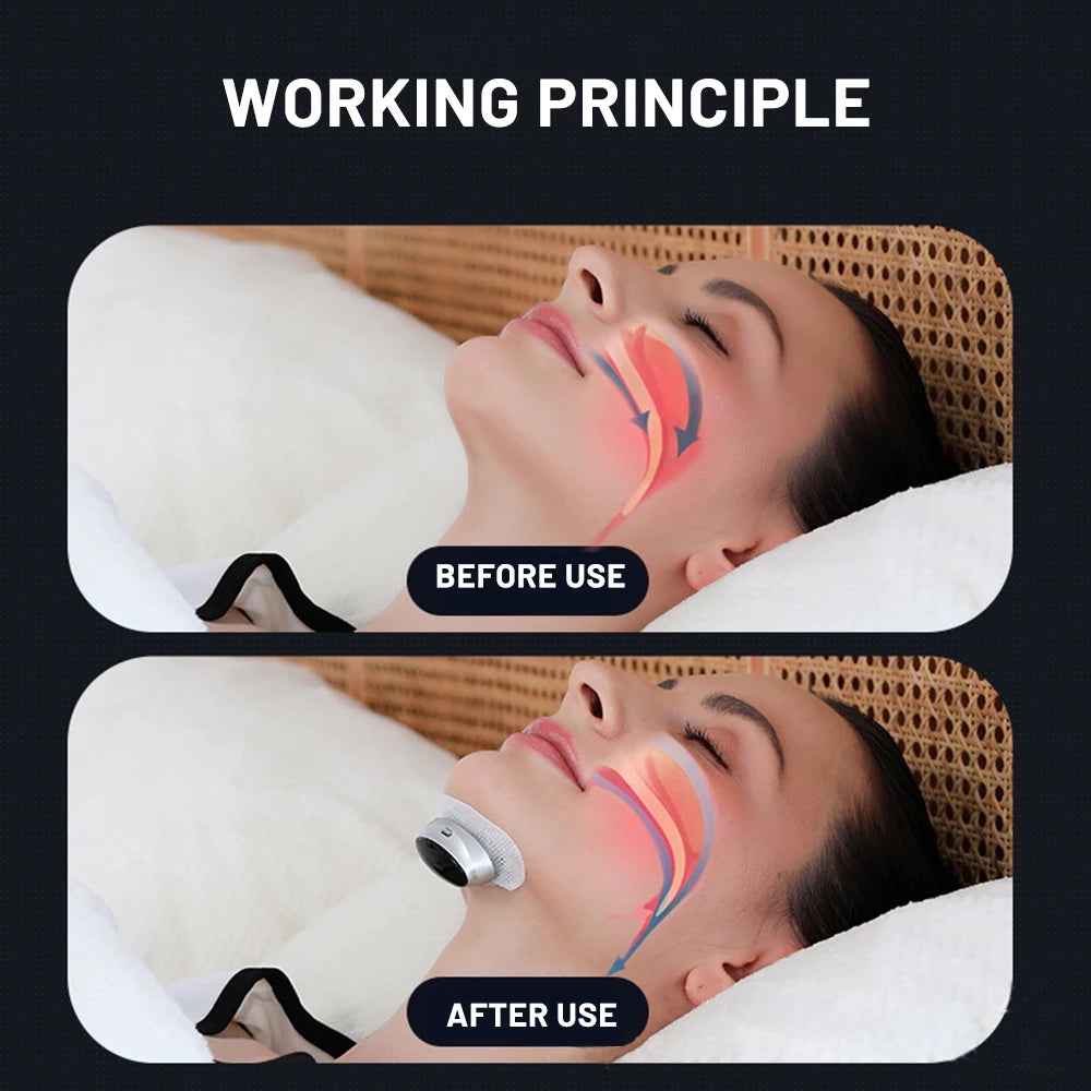 Smart Anti-snoring Device Breathing Corrector Electric Anti Snoring Sleep Pro Smart EMS Anti Snoring Device