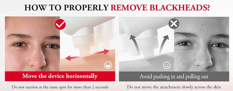 2025 New Blackhead Remover Pore Vacuum With Hot Compress Electric Facial Hydrating Cleaner Pimple Extractor Face Beauty Device